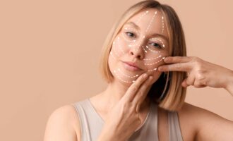 Lifting cervicofacial: cuándo puede plantearse y qué factores se valoran